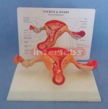 WEST DESK TYPE, COMMON PATHOLOGIES UTERUS & OVARY WIDESCRIPTION PLATE (2 PCS) WITHOUT COVER AND THE LESSER LIPS OF PUDENDUM